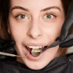 femeie privind camera in timpul unui consult stomatologic